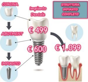 Impianto dentale Albania Prezzi 